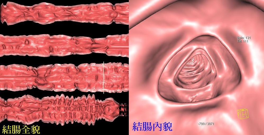 CTfangjhenchangjing