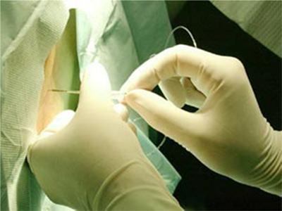 全身麻醉主要适用于头颈部,胸部,或上腹部方面的手术.